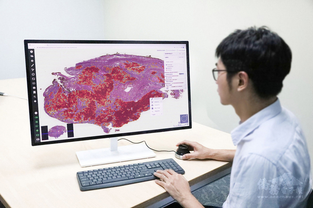 台AI判讀肺癌影像突破　免人工標註3分鐘揪病灶
台北醫學大學巨量影像資料庫研究計畫，以人工智慧AI 
系統開發肺部腫瘤不需人工標註的病理影像辨識系統，
準確率達95%以上，且每名病人僅須3到5分鐘就可判讀
。（北醫大提供）