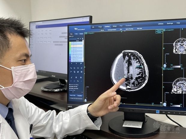 台大醫院宣布與醫隼智慧公司合作研發出全球首款腫瘤自動圈選AI系統VBrain，台大醫院放射腫瘤科主治醫師許峯銘（圖）指出，導入AI系統，可自動圈選協助醫師找出微小不易發現的腦癌。