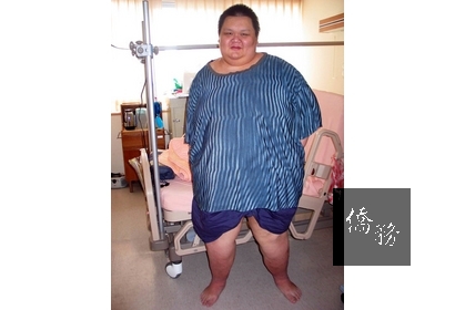 肥胖患者身上的皮膚皺摺較多且深,容易滋生細菌、黴菌,造成念珠菌感染、股癬、體癬、毛囊炎等皮膚症狀。