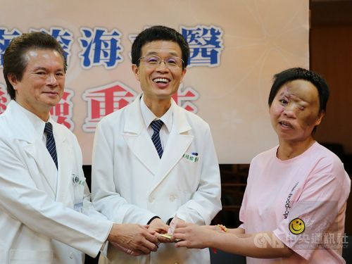 Lyn-lyn (right)/Photo courtesy of Hualien Tzu Chi Hospital